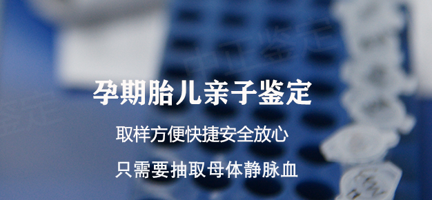 南京孕期亲子鉴定准确性高吗, 南京孕期亲子鉴定准确性高吗,